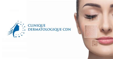Clinique Dermatologique Cdn Dermatologie Et Chirurgie