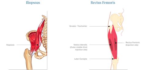 Tendons are the tissues that attach the bones to the muscles in your body. What Muscles Attach Left Hip And Back / The Essential Role ...