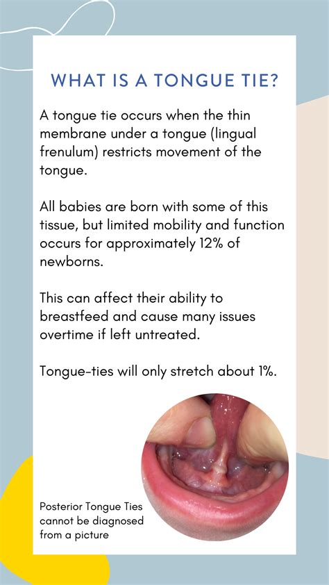 The Impact Of Tongue Ties Oral Restrictions Sunnyseed