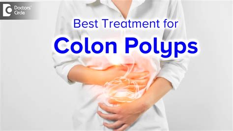 When Is A Colon Polyp Removed Laparoscopically How Is It Done Dr