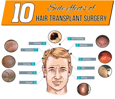 10 Side Effects Of Hair Transplant Surgery AK Clinics