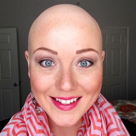 Bald Is Beautiful The Message That Got One Young Girl