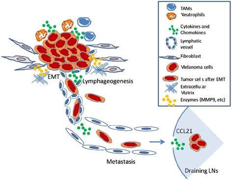 Model Of Melanoma Cell Metastasis To Regional Lns The Process Of