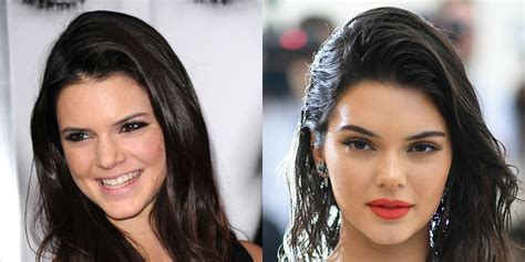 Kendall Jenners Beauty Transformation