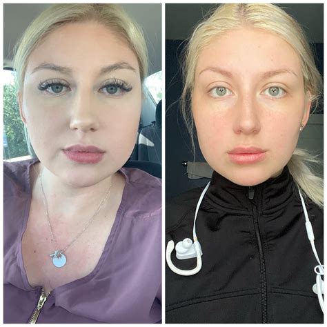 How do i lose face fat reddit. Keto face weight loss : vegetarianketo