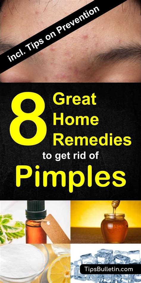 How To Get Rid Of Pimples With 8 Excellent Home Remedies Including