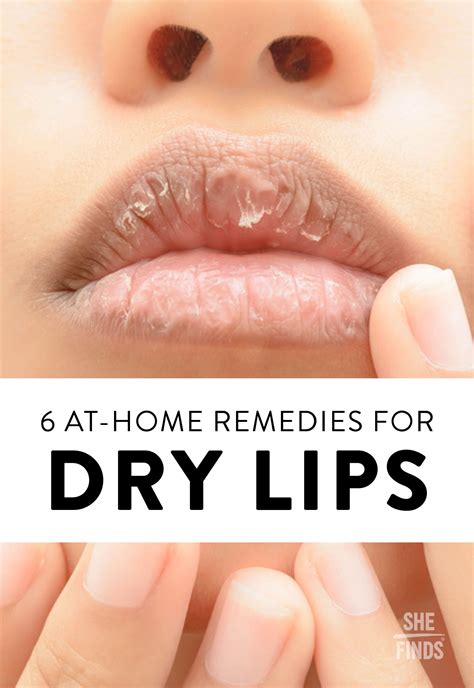 at home remedies for dry lips remedies for chapped lips dry lips remedy dry lips lip beauty