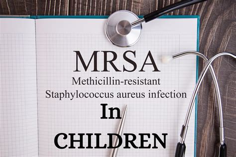 Mrsa In Children Causes And Treatment By Dr Srikanta J T Being The