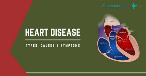 Heart Disease Types Causes And Symptoms Columbia Asia Hospital