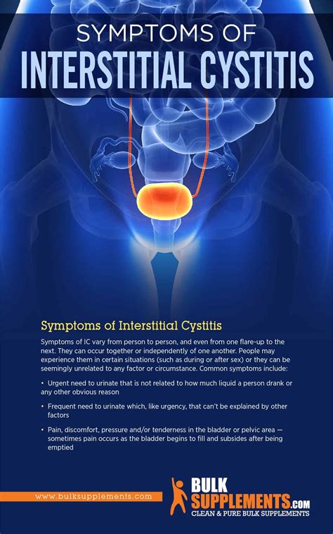 Interstitial Cystitis Bladder Pain Syndrome Causes Symptoms And Treatment Hot Sex Picture