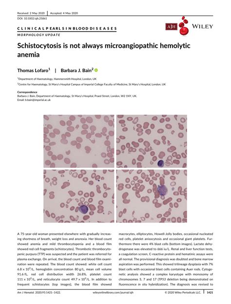 Schistocytosis Is Not Always Microangiopathic Hemolytic Anemia