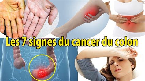 7 signes de cancer du côlon que les gens ignorent conseils youtube