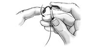 They work to prevent pregnancy by releasing small amounts of the hormone. Intra Uterine Device (IUD) | The Royal Women's Hospital