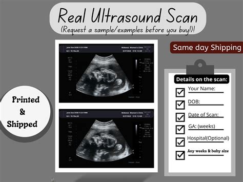 Pin on Fake Ultrasound Picture