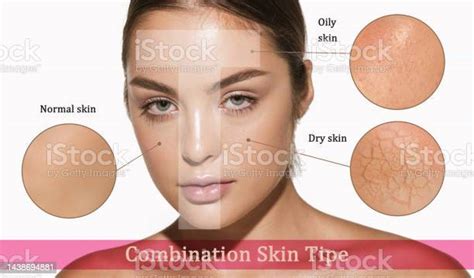 Female Face With Different Skin Types Dry Oily Normal Combination Tzone