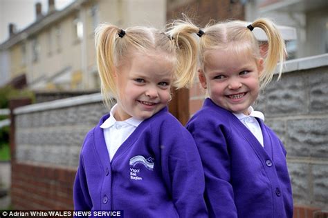 miracle twins defy odds to start school together after surviving radical laser surgery in the