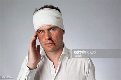 Forehead Bruise Photos And Premium High Res Pictures Getty Images