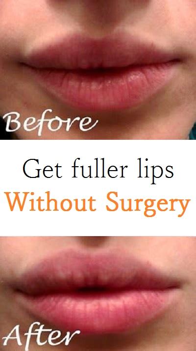 Get Fuller Lips Without Surgery How To Beauty