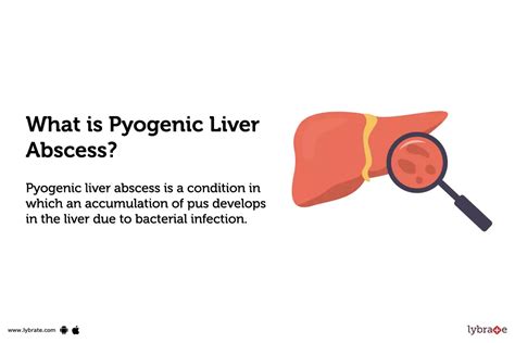 Pyogenic Liver Abscess Causes Symptoms Treatment And Cost
