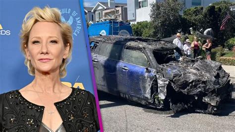 Anne Heche Dead At 53 Official Cause Of Death Ruled A Timeline Of Her