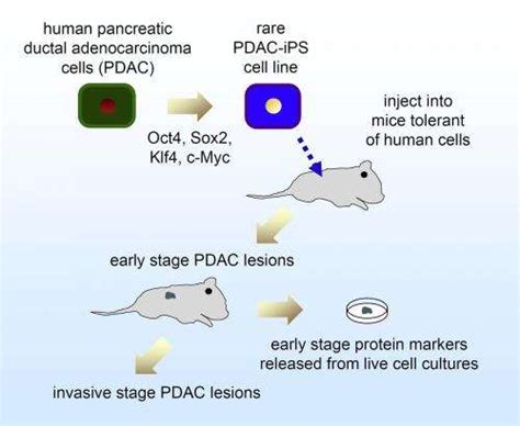 Pluripotent Cells From Pancreatic Cancer Cells First Human Model Of