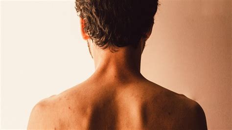Back Acne What Causes Acne And How To Prevent It Koko Glow