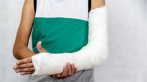 7 Easy Elbow Fracture Rehabilitation Exercises