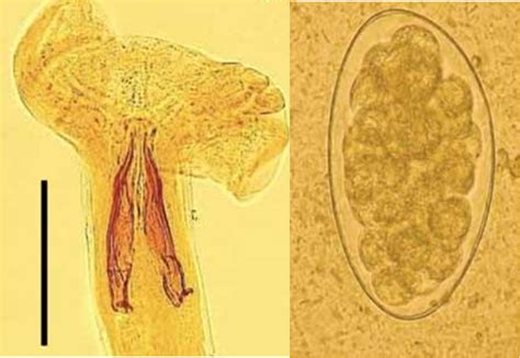 Trichostrongylus Colubriformis Archivi Microbiologia Italia