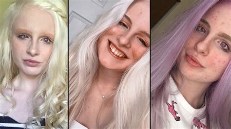 Albino Woman Becomes Online Sensation Thanks To Violet Coloured Eyes
