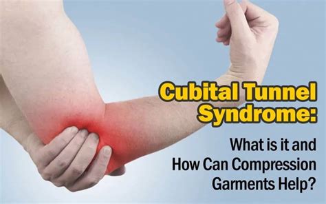 Cubital Tunnel Syndrome Brace Learn How Cubital Tunnel Syndrome Elbow