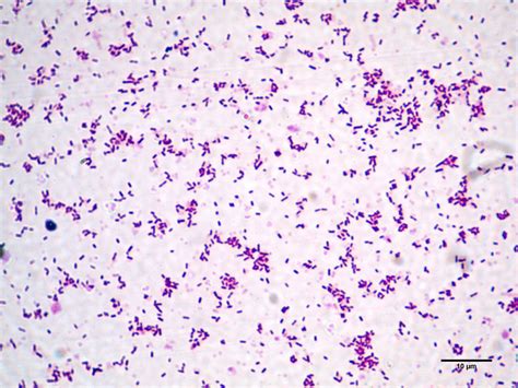 However, with older cultures the gram stain reaction can be variable and also cells may appear. Листериоз фото