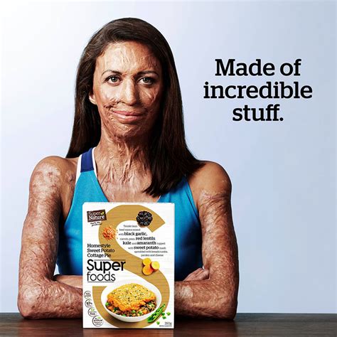 Shedcsc Launches New National Campaign For Super Nature Featuring The Incredible Turia Pitt