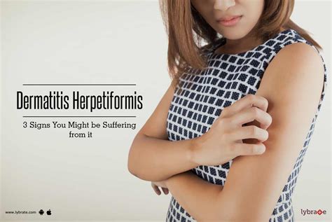 Symptoms Of Dermatitis Herpetiformis By Dr Nitin Jain Lybrate My XXX Hot Girl