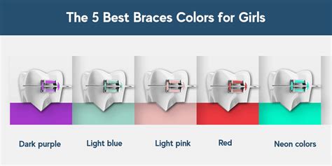 Best Braces Colors For Work School And To Make Teeth Whiter