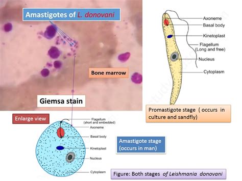 Leishmaniasis Introduction Classification Pathogenesis Lab Diagnosis