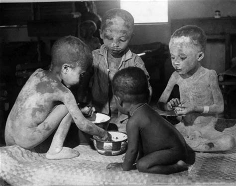 Biafra La Guerre Et La Famine