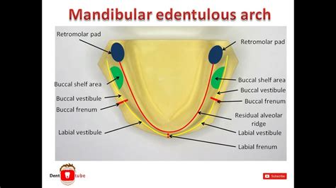 Anatomical Landmarks In Mandibular Edentulous Arch Youtube