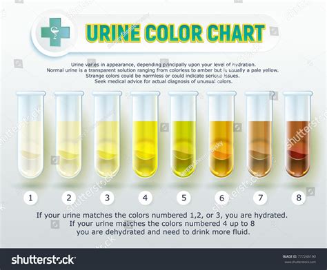 9 654 Urine Color Images Stock Photos Vectors Shutterstock