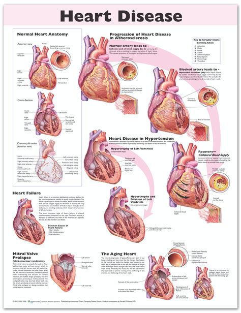 Reference Chart Heart Disease