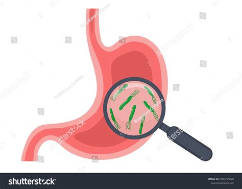Illustration Study Stomach Helicobacter Pylori Bacteria Stock Vector
