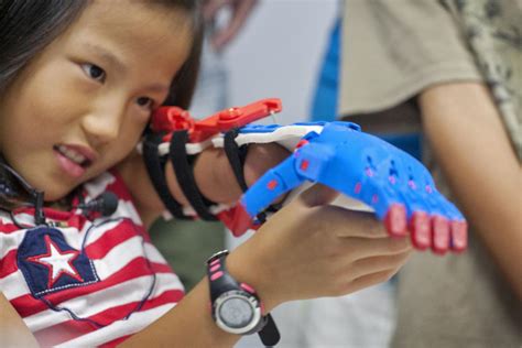 Technical Institute Engineers Free Prosthetics For Kids Using 3 D Printer