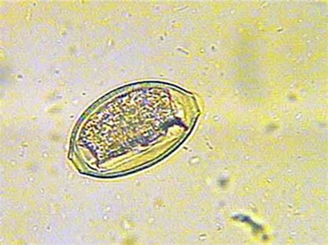 Companion Animal Parasite Council Urinary Tract Nematodes