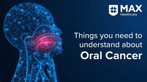 What Do You Need To Know About Oral Cancer