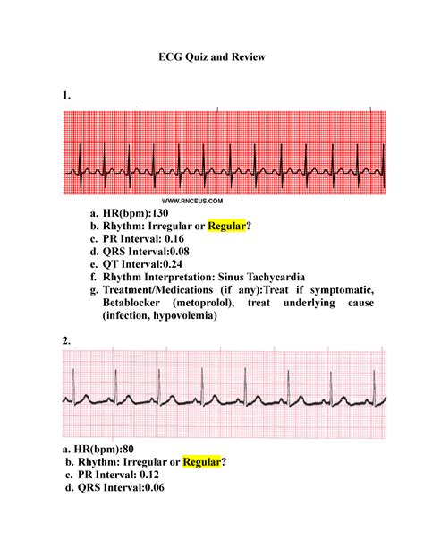 EKG Interpretation With Answers - ECG Quiz and Review 1. a. HR(bpm): b
