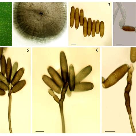 Bipolaris Spicifera 1 Symptoms Developed On In Vitro Inoculated Download Scientific Diagram