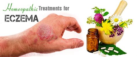 Eczema Miracles With Homeopathy