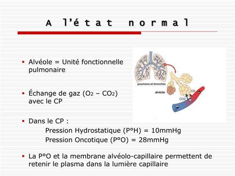 Ppt Insuffisance Cardiaque Aigue Powerpoint Presentation Free