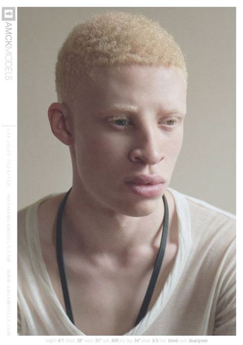 Albino Albino Model Shaun Ross Albinism
