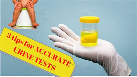 3 Tips To Collect Urine Sample For Your Child Youtube