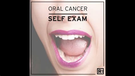 oral cancer self exam step by step youtube